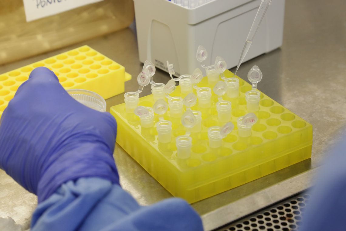 Fiocruz recebe material genético do coronavírus para aprimorar testes