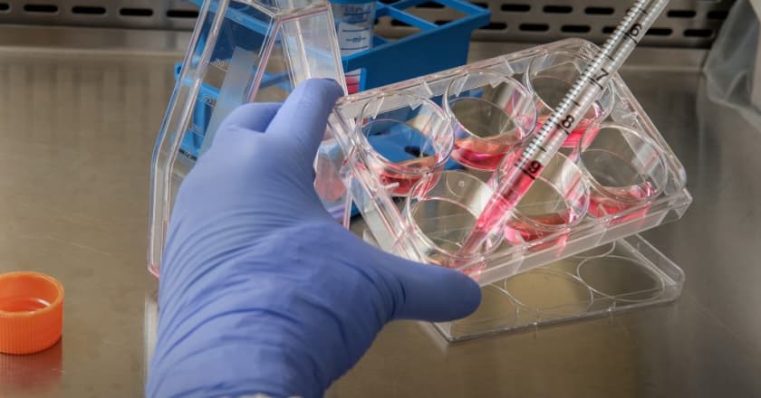 Laboratório Curitiba Coronavírus teste exame dez dias
