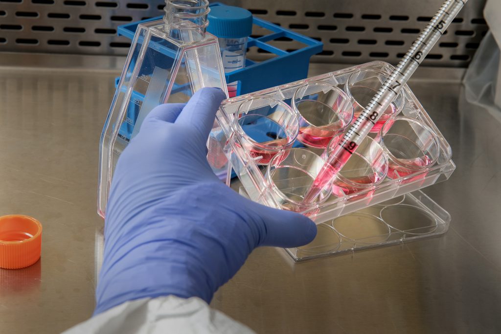 Laboratório de Curitiba tem exame para detectar Coronavírus