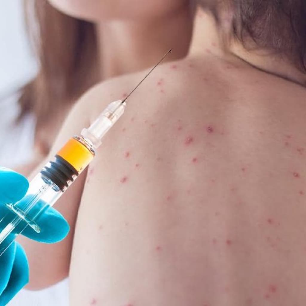 Vacina contra sarampo estará disponível no Paraná até 30 de outubro