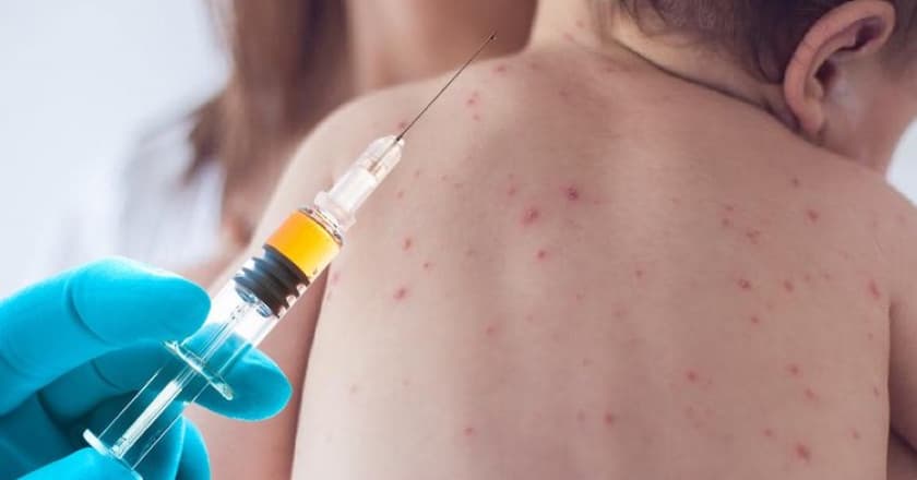 Vacina contra sarampo estará disponível no Paraná até 30 de outubro