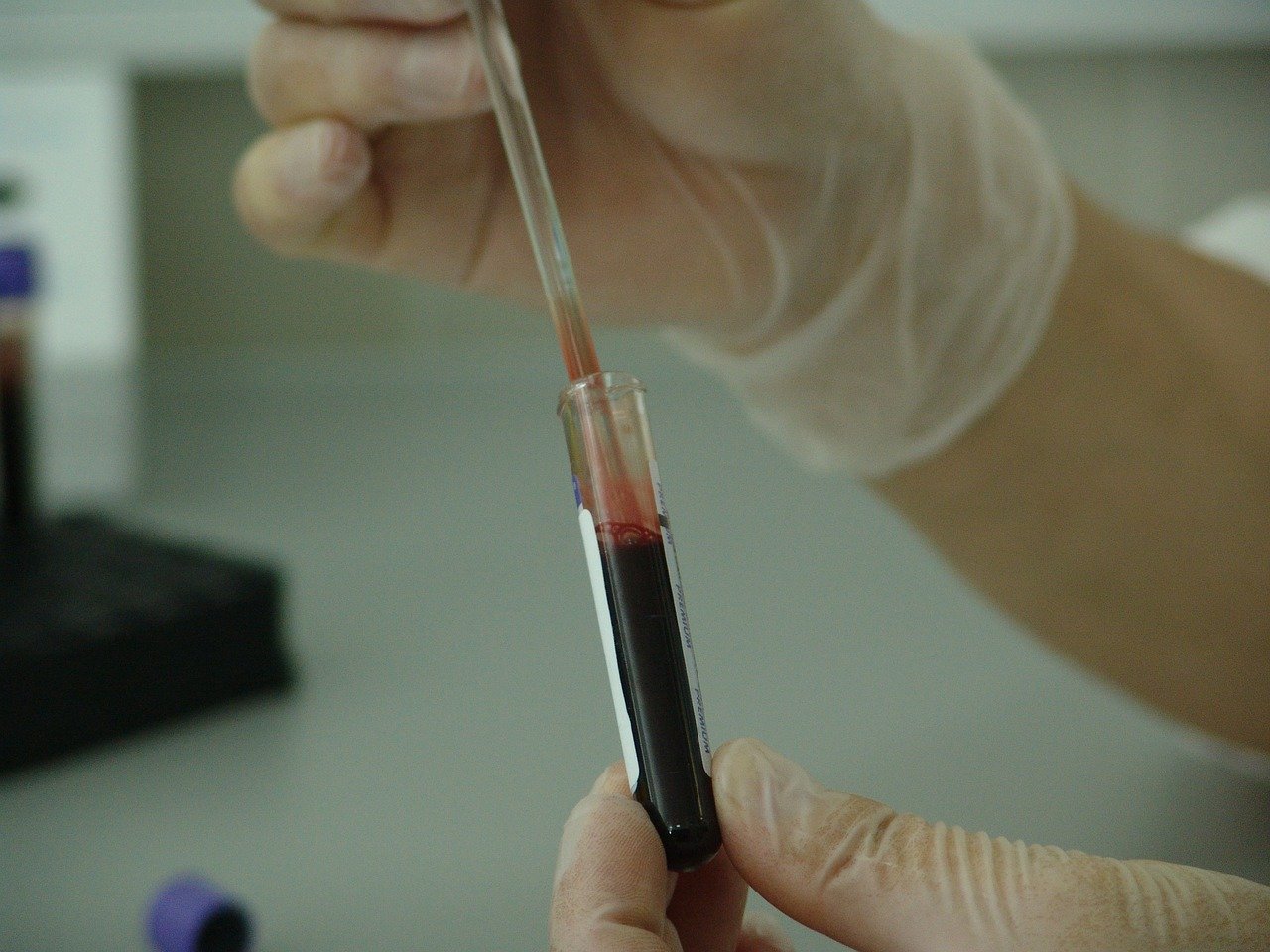 Pesquisadores brasileiros testam soro hiperimune para tratar a Covid-19