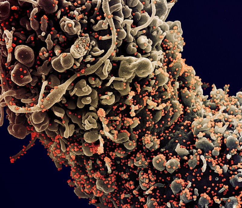 Coronavírus pode se tornar endêmico como o HIV, diz OMS