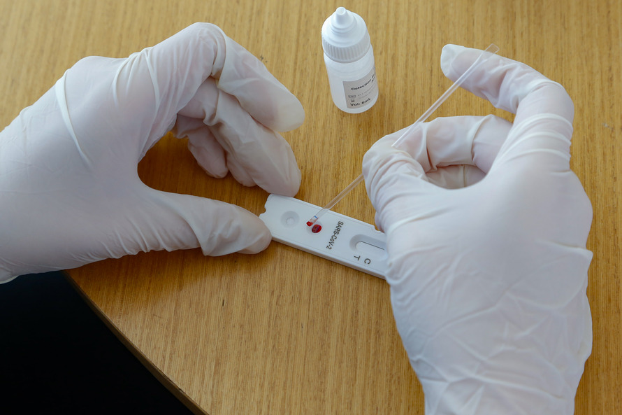 Covid-19: Paraná é o segundo estado que mais realiza exames RT-PCR
