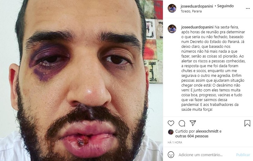 Médico é agredido por conhecidos após defender medidas de restrição no Paraná