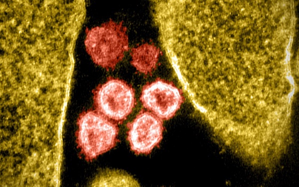 Célula infectada pelo novo coronavírus (NIAID)