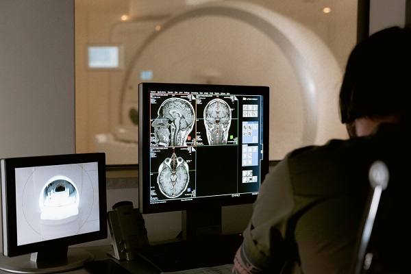 Inteligência artificial pode ajudar no diagnóstico de acidentes vasculares encefálicos; entenda