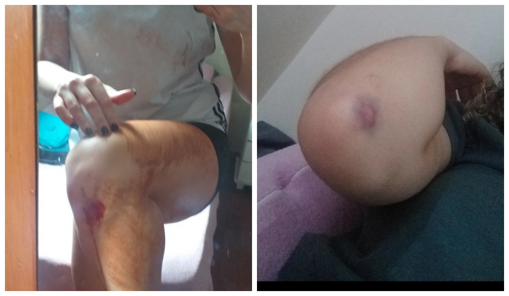 Jovem é atacada enquanto praticava exercício no Lago Igapó, em Londrina
